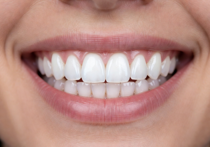 Bright white smile close-up showing result of professional teeth whitening